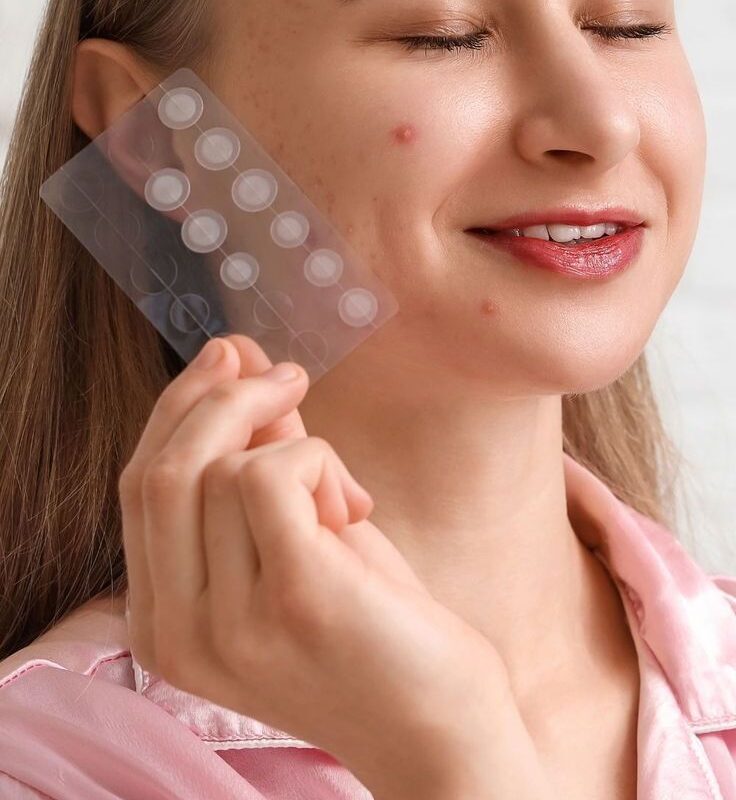PARCHES DEL ACNE
